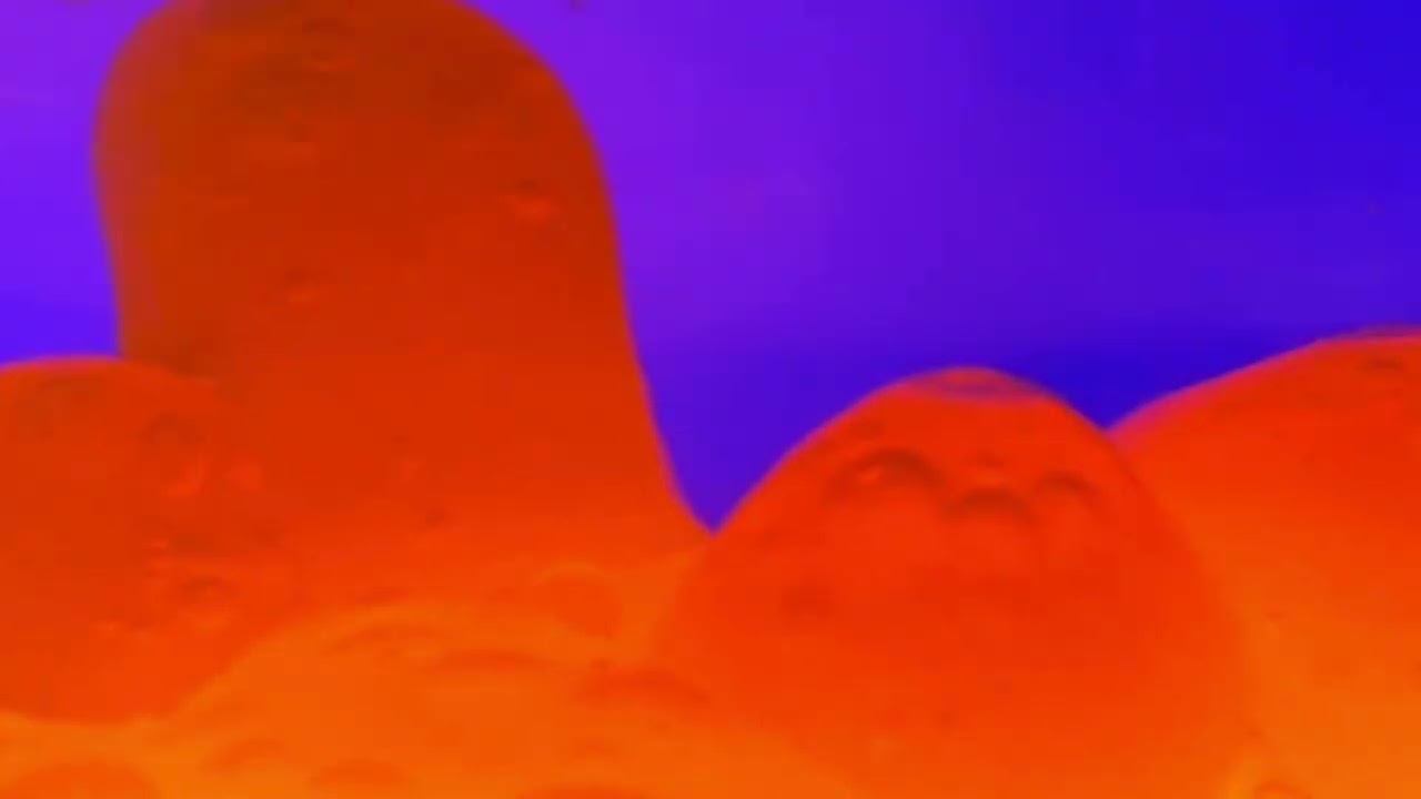 Singing Stars (Close-up of a digestive system with gas and hiccups)